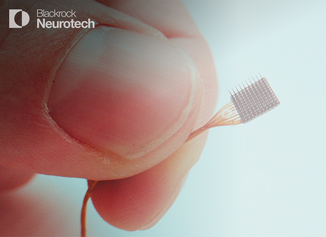Blackrock Neurotech - undefined case study preview by AE Studio