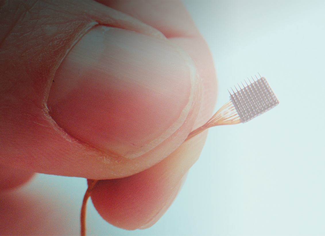 MoveAgain BCI Platform - undefined case study preview by AE Studio